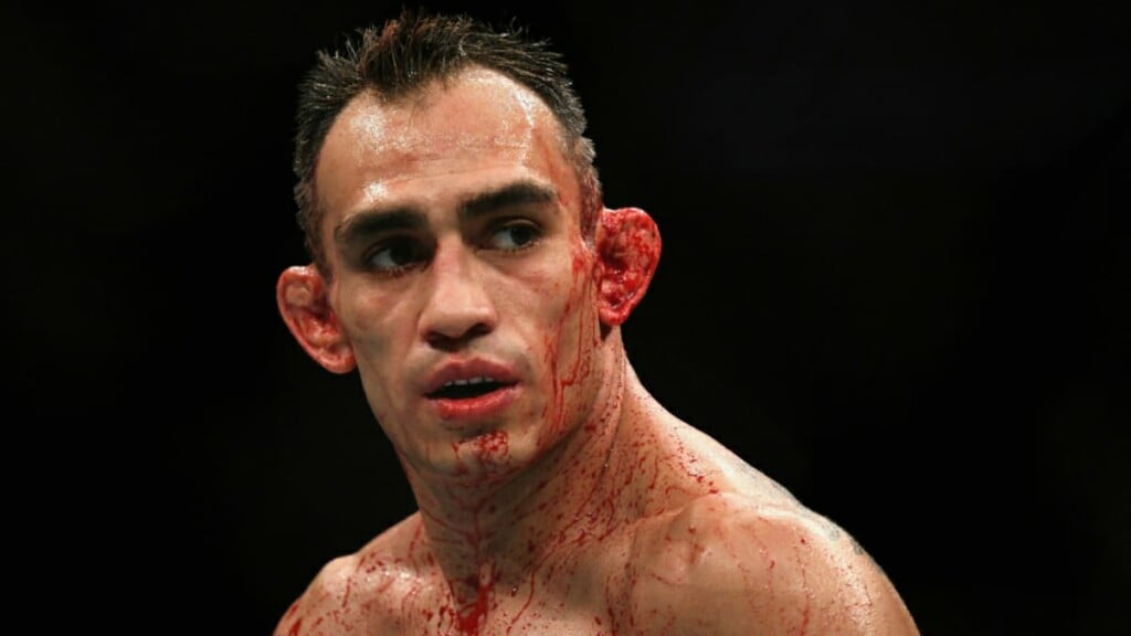 Tony Ferguson UFC