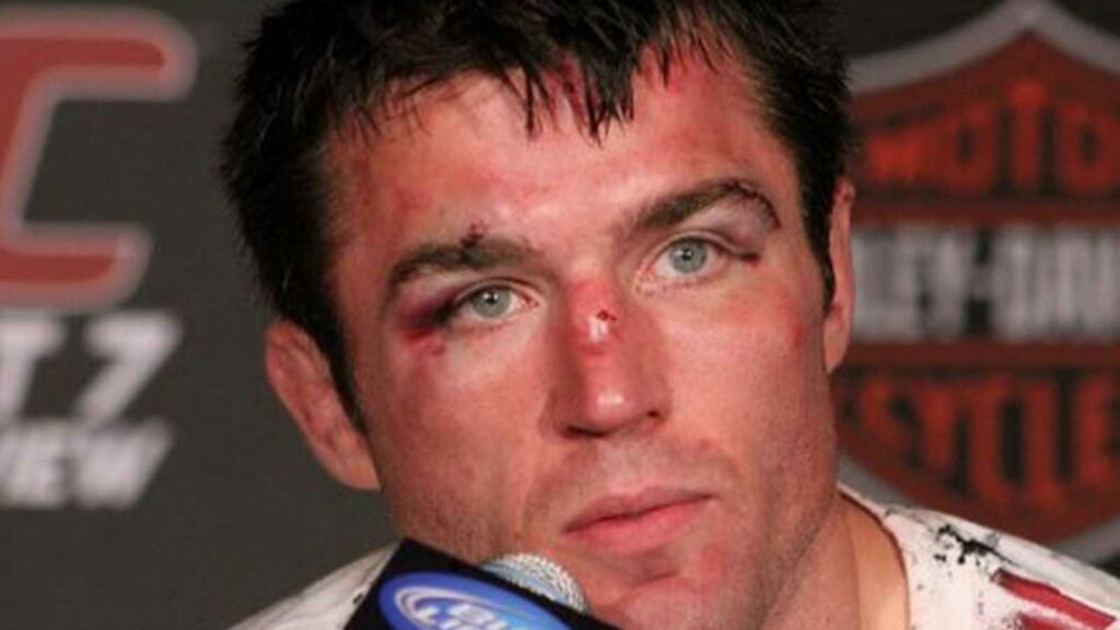 Chael Sonnen speaks after his loss to Anderson Silva [Image Courtesy - MMA Mania]