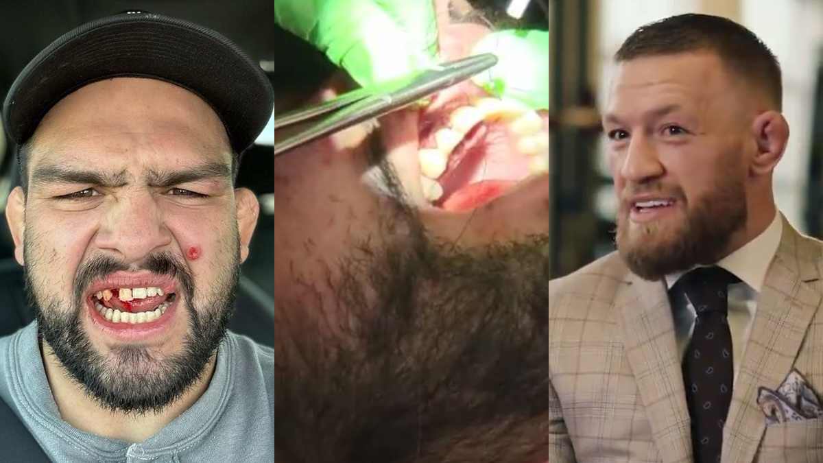 “That’s full on staph infection,” Conor McGregor appalled by ‘scruff’ Kelvin Gastelum’s recent injury