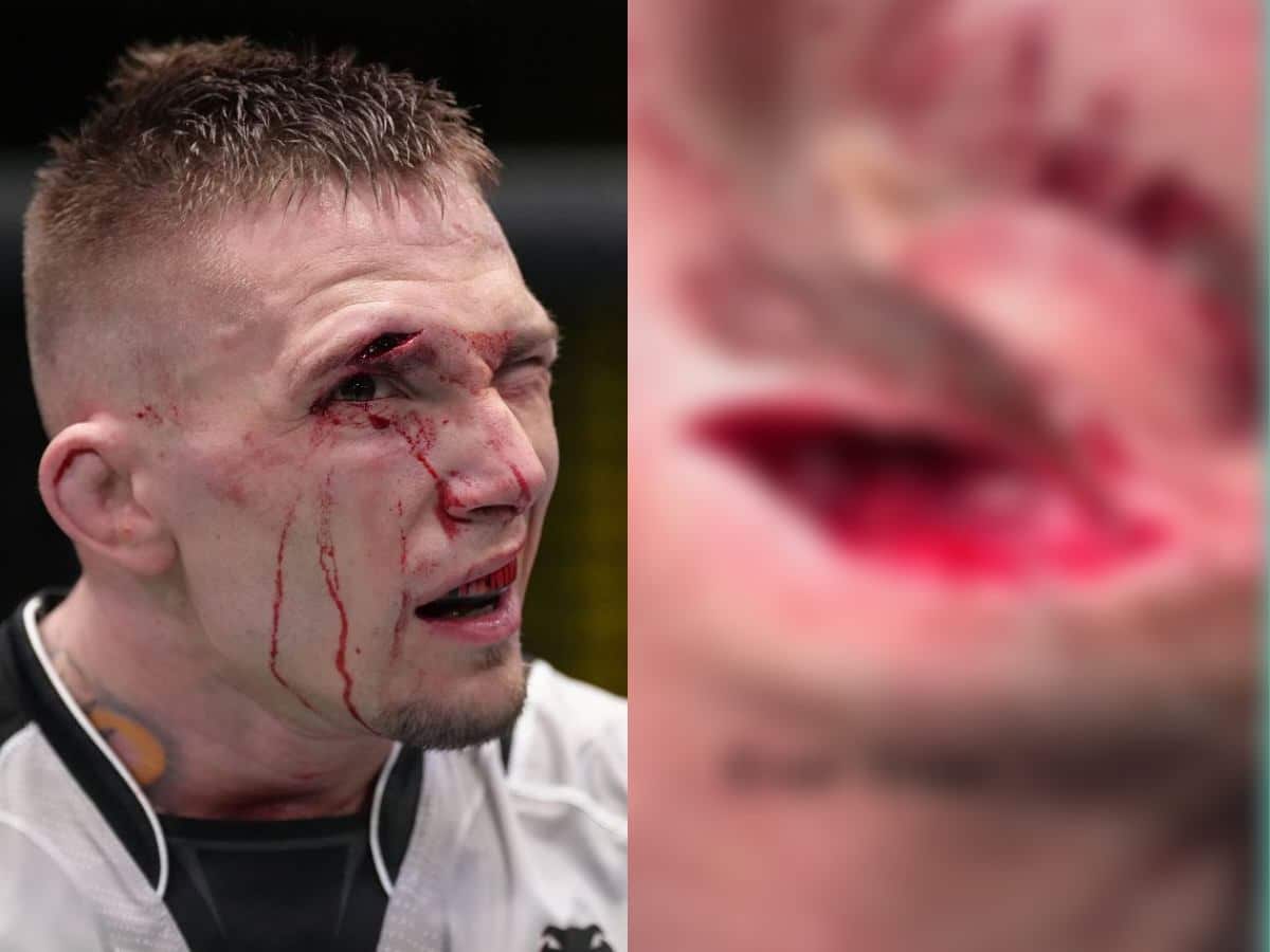 HORRIFYING! Dana White tracks back on referee slander after seeing fighter’s terrifying cuts post fight