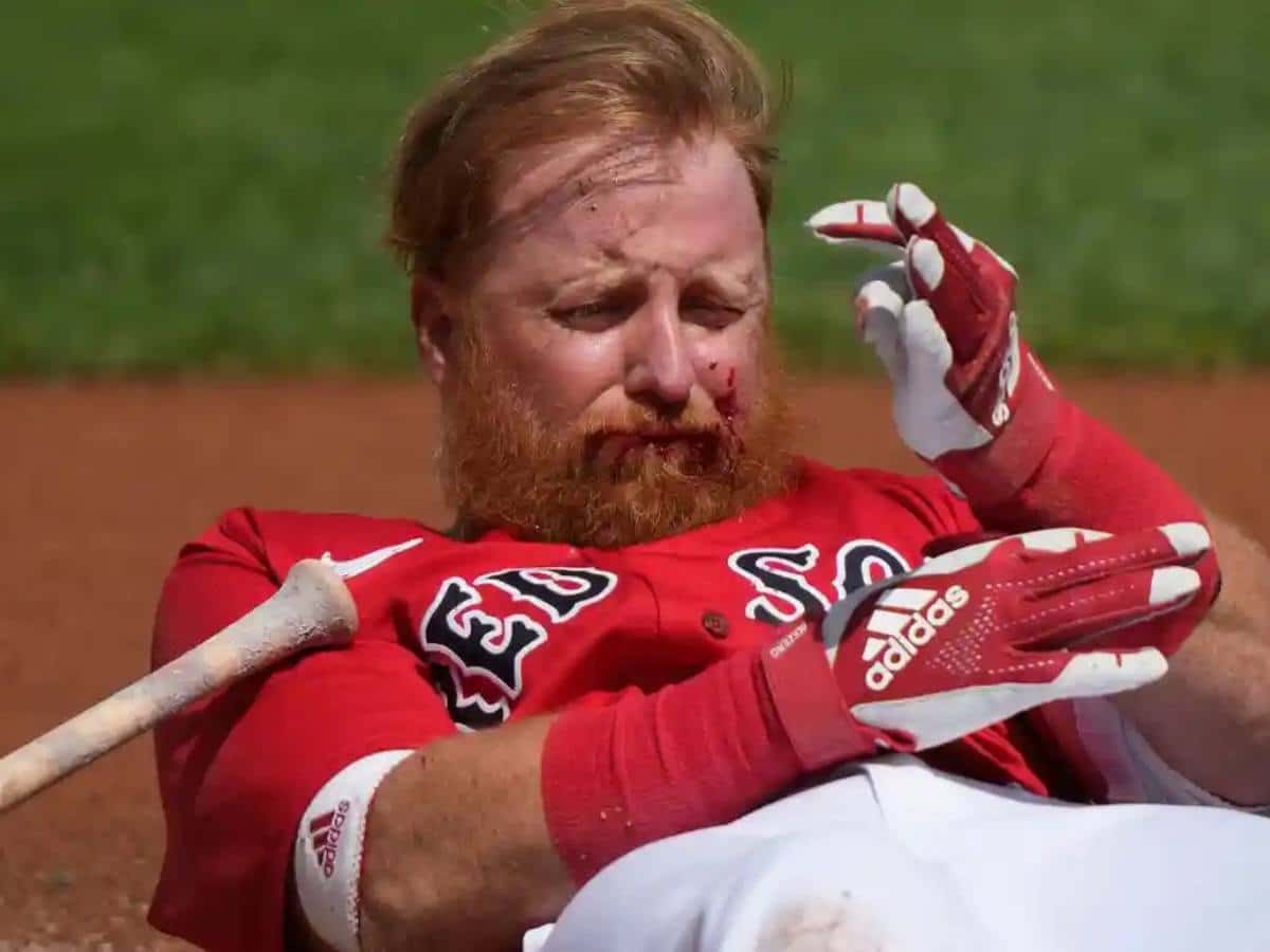 “Bad things happen to good people,” MLB Twitter blames the Red Sox management after Justin Turner gets hit on face by Matt Manning’s pitch