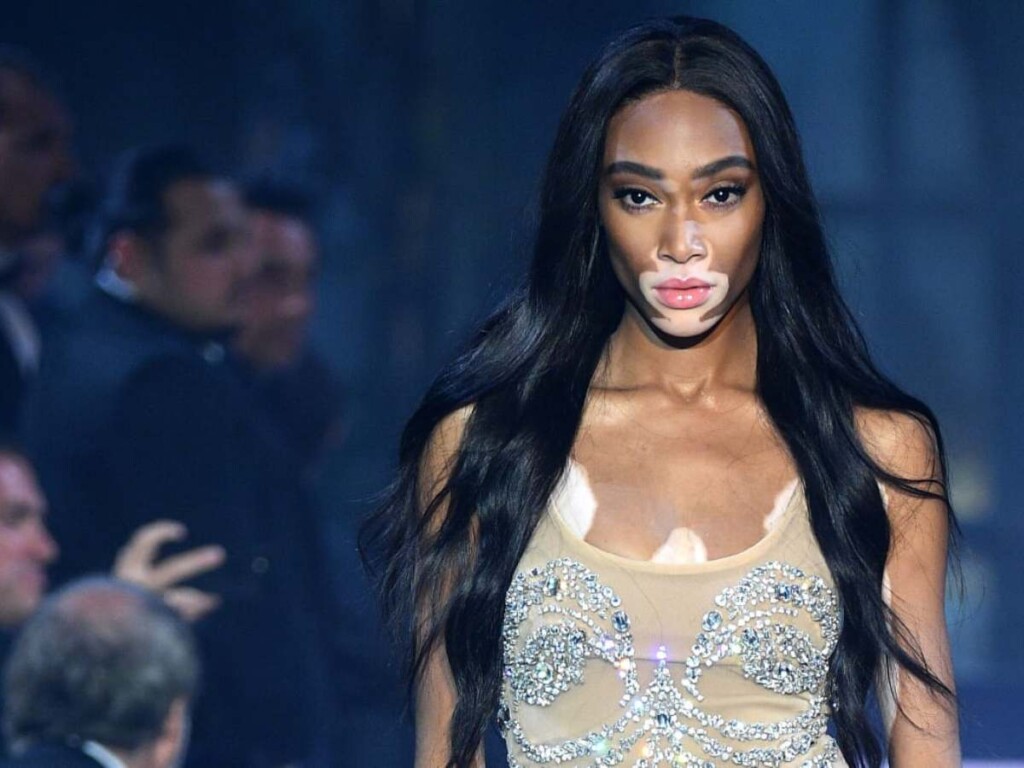 Winnie Harlow