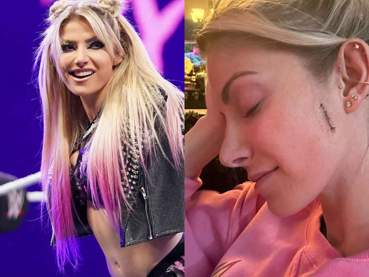 Alexa Bliss shares health update saying she currently looks like “Frankenstein”