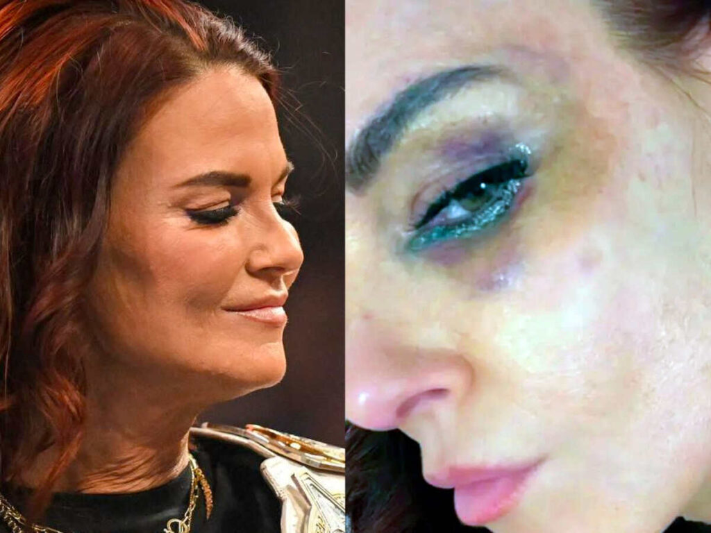 Lita's black eye