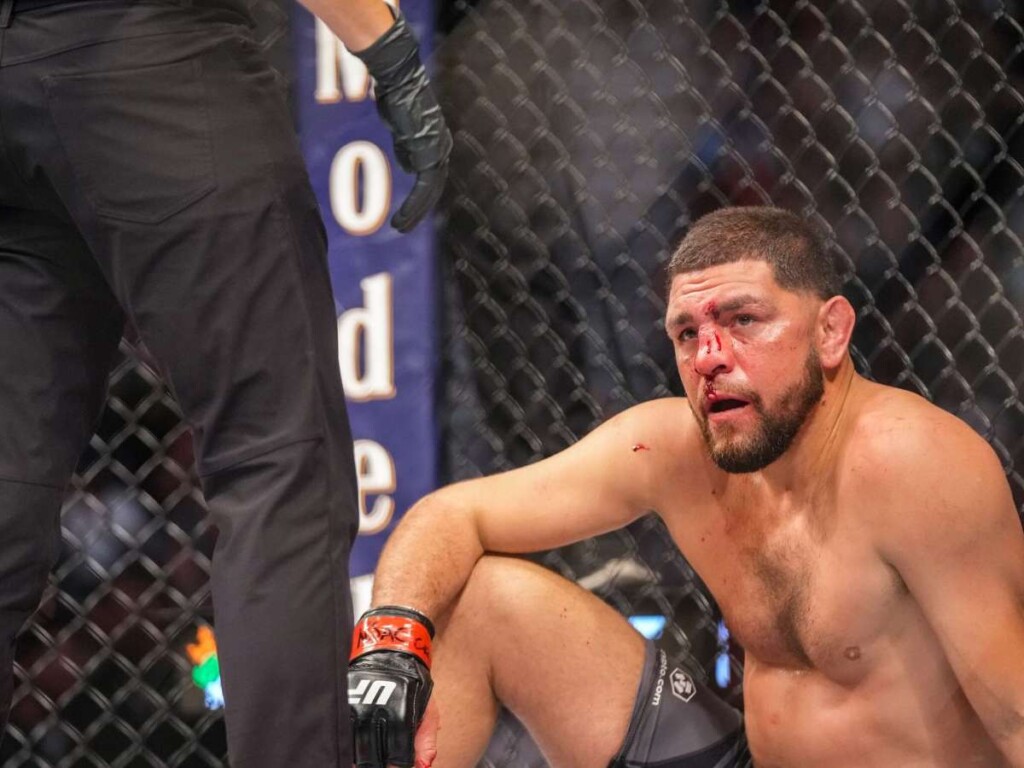 Nick Diaz out of shape at UFC 266