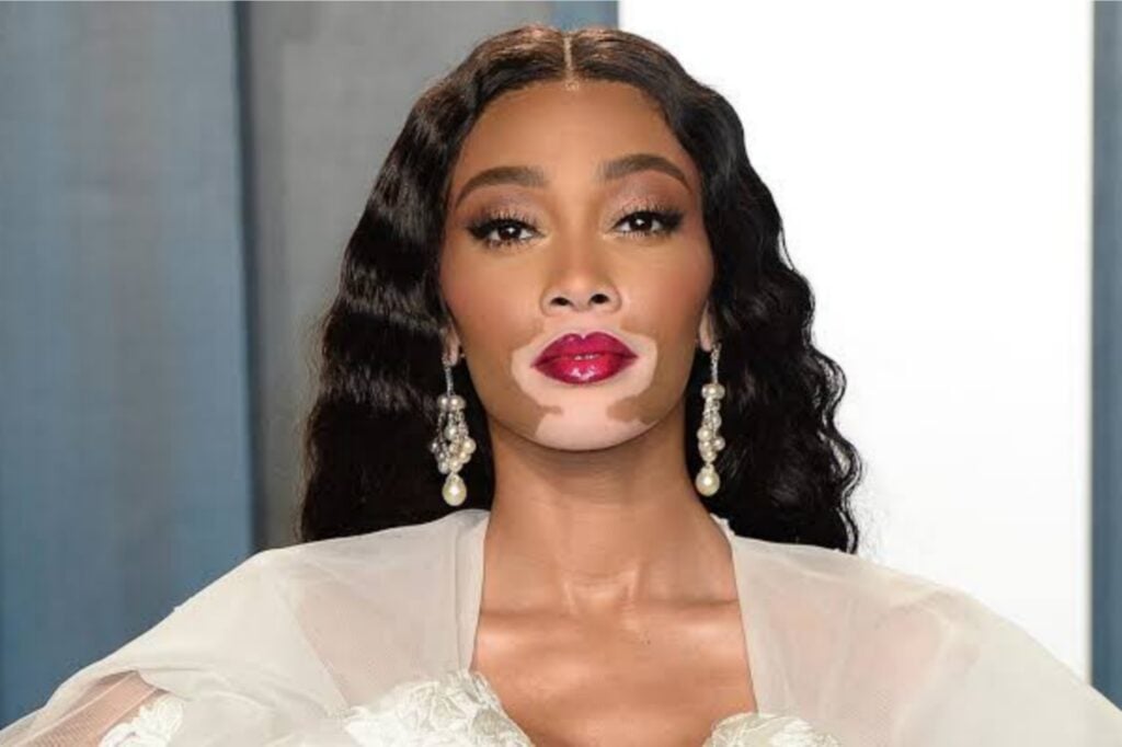 Who is Kyle Kuzma’s Girlfriend, Winnie Harlow? 5 Winnie Harlow