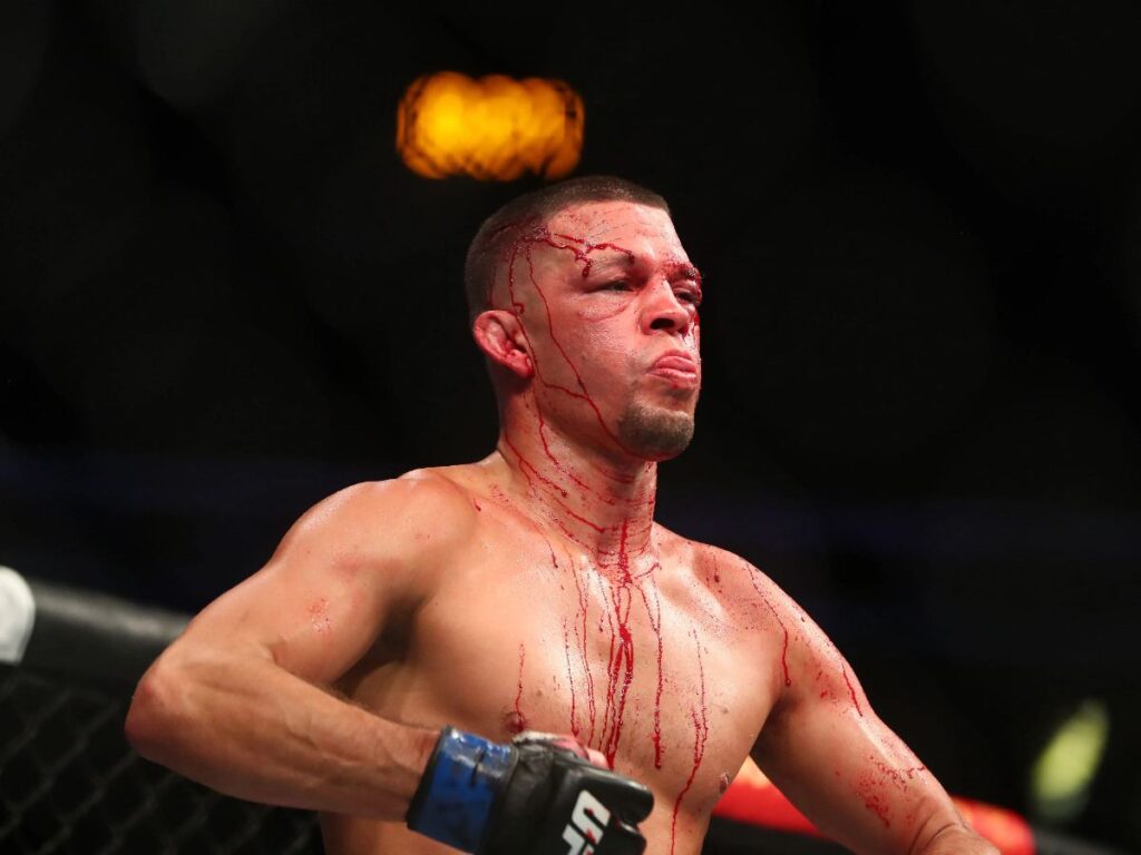 Fans surprised at Nate Diaz in Custody (Image Source - Stockton Record)