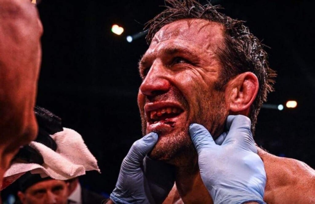 Rockhold Lost tooth 