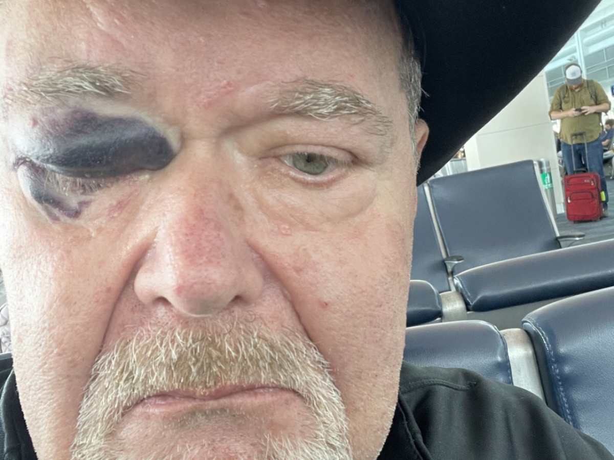 WWE Hall of Famer Jim Ross shares concerning photo after suffering a horrific fall before AEW Collision