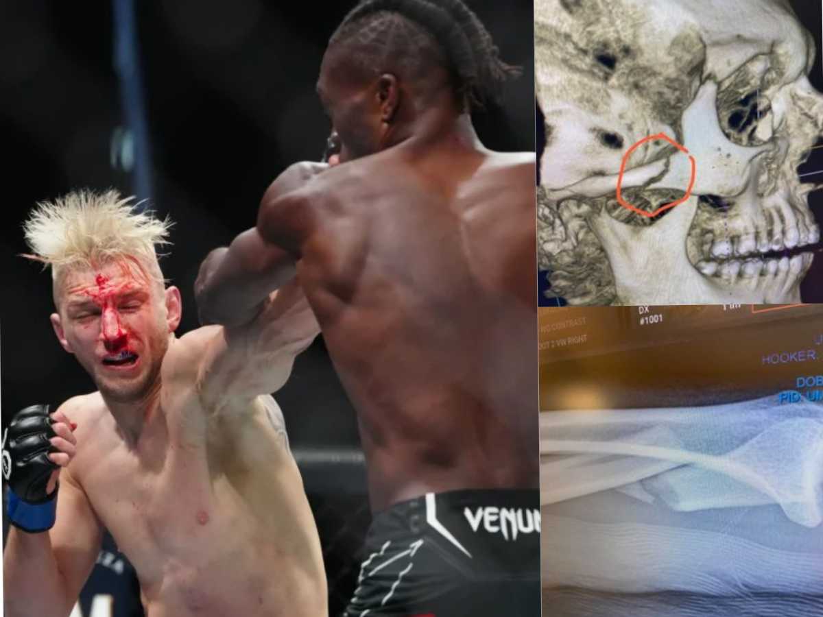 “Toughest dude God’s put on this earth” – Fans demand BMF title for Dan Hooker after courageous UFC 290 performance despite horrific fractures