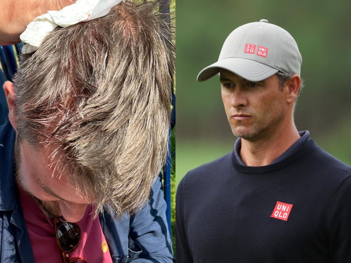 WATCH: Adam Scott’s stray ball leaves unlucky fan in BLOODIED state at The Open Championship