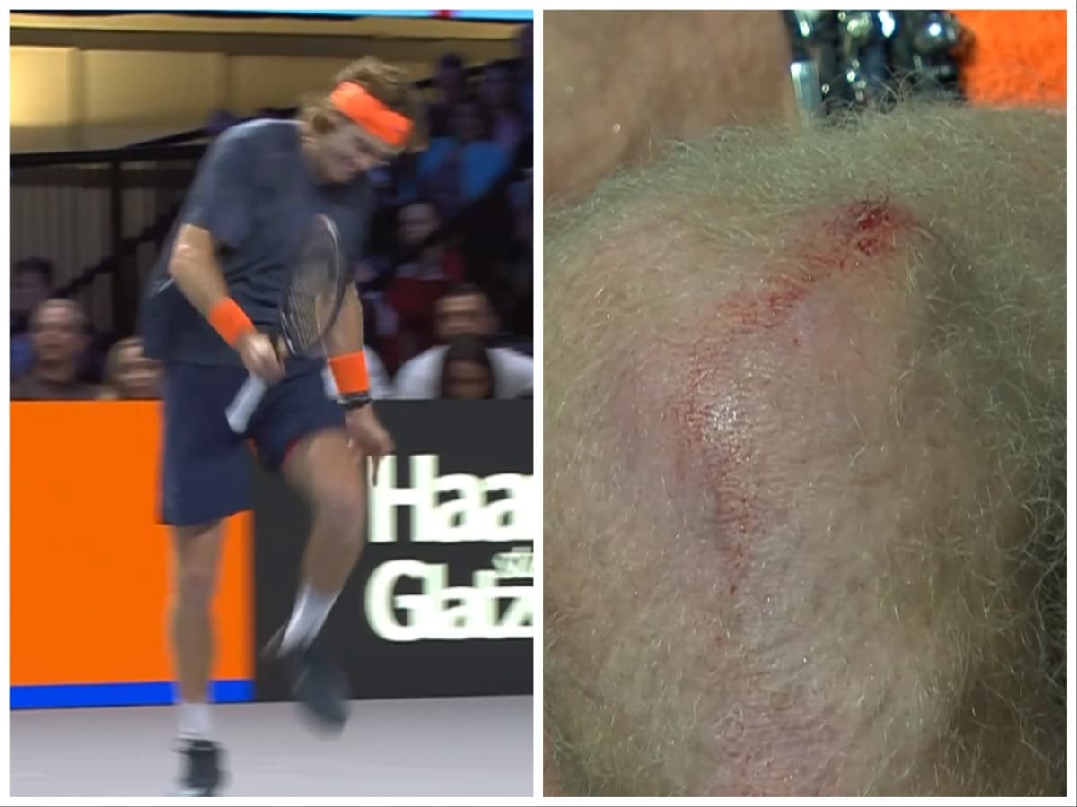 Andrey Rublev’s knee starts bleeding as he hits himself in frustration, Serena Williams’ ex-coach fires shots