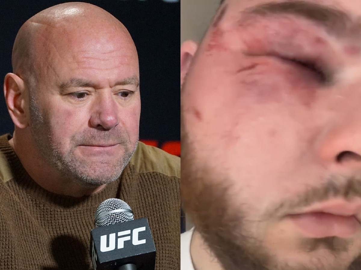 Graphic Warning: ‘All that for $250’ – Fans in shock after seeing Dana White’s Power Slap athlete shares video of GRUESOME aftermath from slap competition