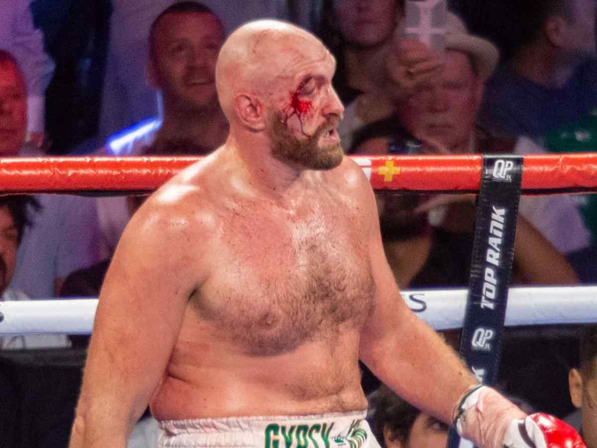 Tyson Fury