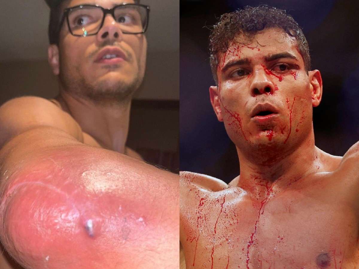 Paulo Costa reveals having surgery weeks before Khamzat CHimaev fight