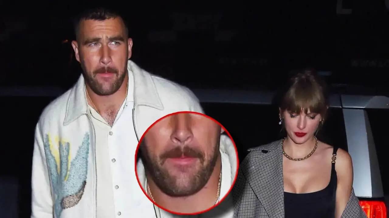 Taylor Swift’s dark red lipstick marks near Travis Kelce’s lips has social media conspiring a makeout session between the two stars last weekend