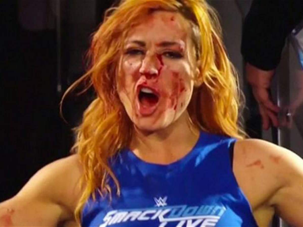 “I can’t wait to do it again!” 39-year-old Superstar warns Becky Lynch to break her nose again on anniversary of her iconic moment in WWE