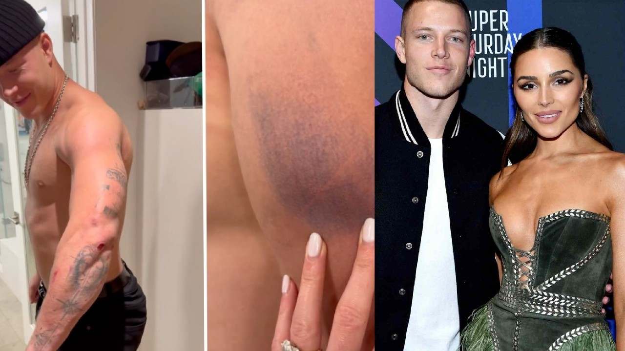 Christian McCaffrey’s fiancee Olivia Culpo STUNNED by her partner’s extreme bruises after the Seahawks game on Thanksgiving