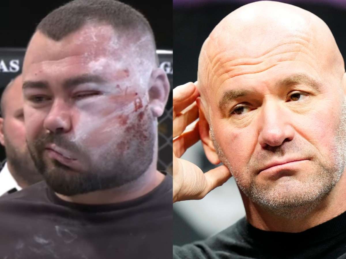 ‘INS*NE’ Dana White bashed for signing infamous slap fighter who went viral for swelled-up face