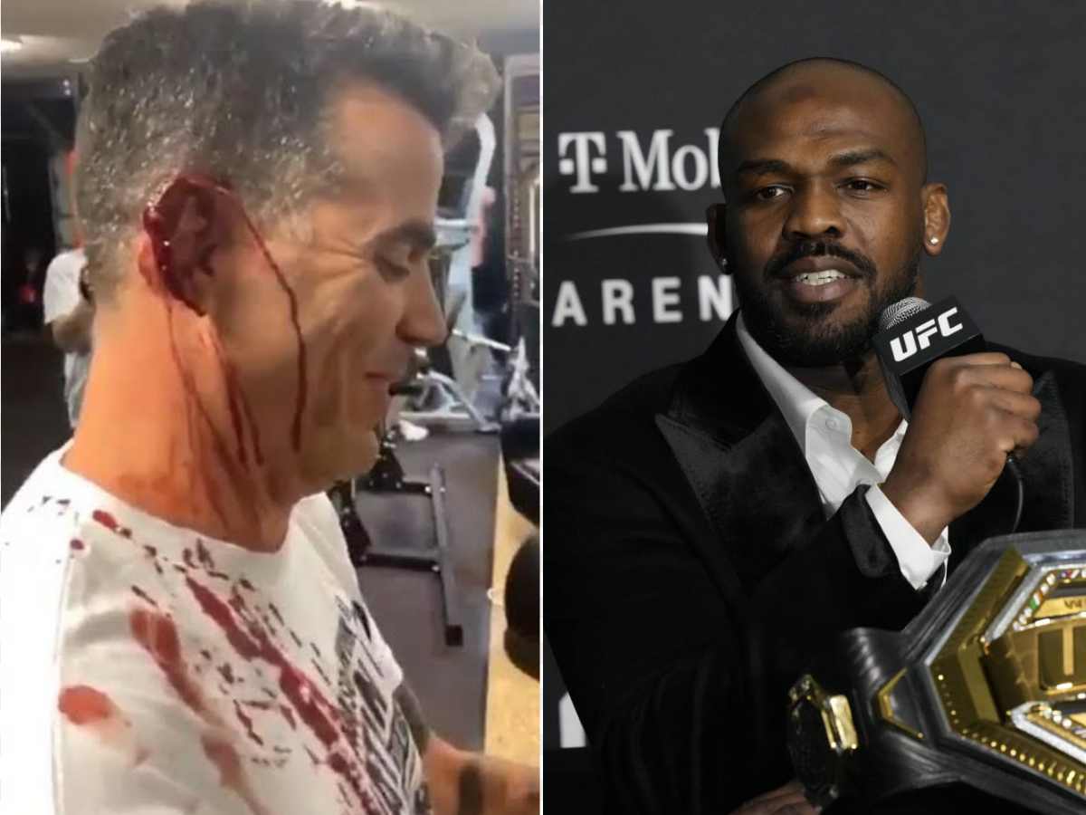 WATCH: Jon Jones makes BLOODY mess out of comedian Steve-O’s ears with UFC belt and hammer