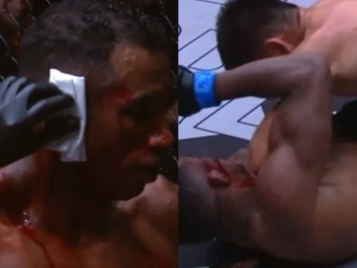 WATCH: Graphic Warning! Cauliflower ear of fighter BURSTS open as opponent lands devastating elbow