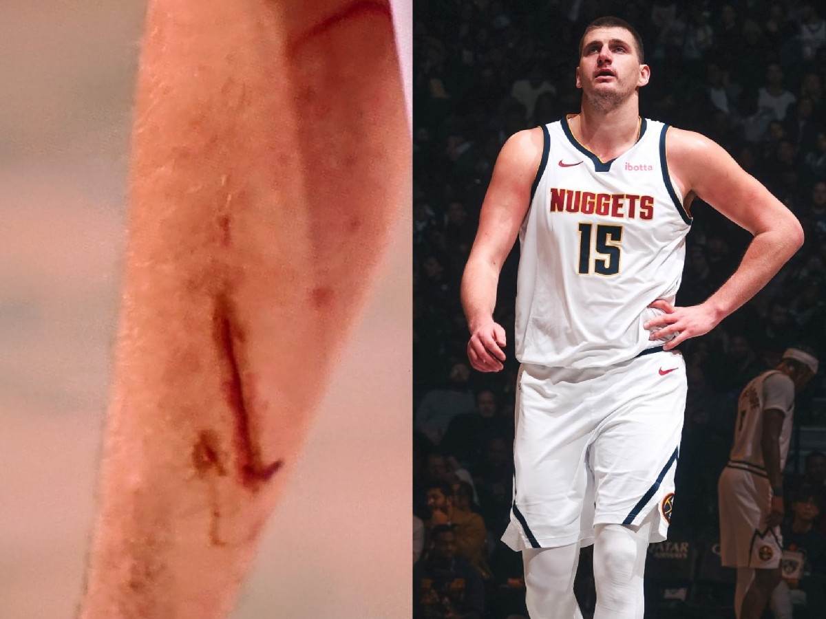 WATCH: “Embiid woulda got 14 free throws for that!” – Nikola Jokic’s nasty gash that stained his jersey with blood irks fans on social media