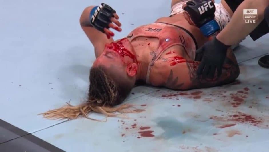 “Looks like she got jumped” – Women’s bantamweight ends in blood-spill at UFC 297 as Canadian star beats up Brazilian for missing weight