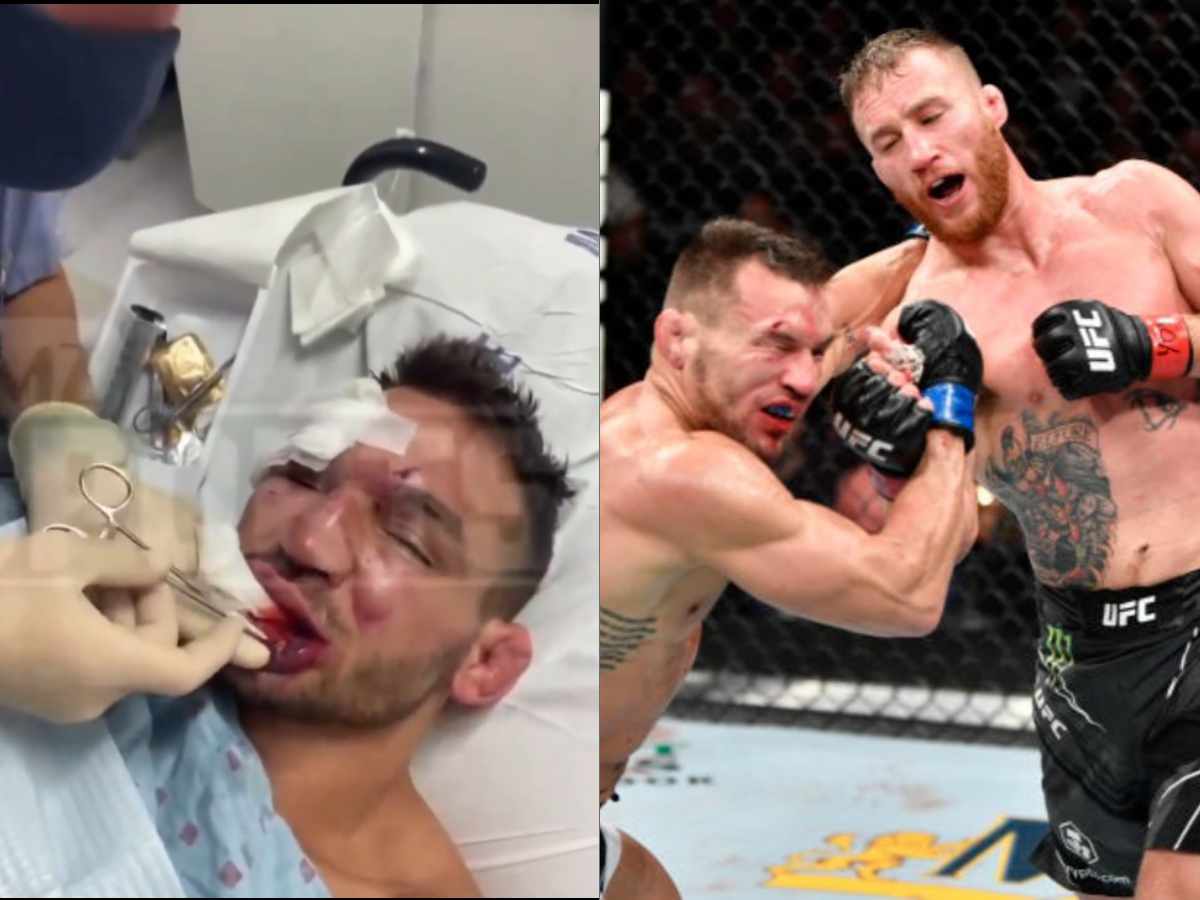 GRAPHIC WARNING! Michael Chandler getting stitches after fighting Justin Gaethje makes rounds on internet leaving fans in shock