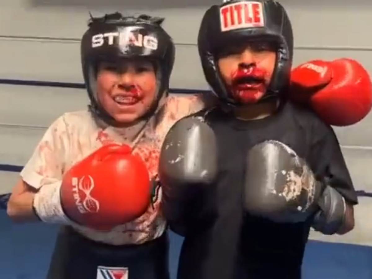 “The parents need to be jailed” – 10-year-old kids left BLOODY after sparring has fight world worrying for future