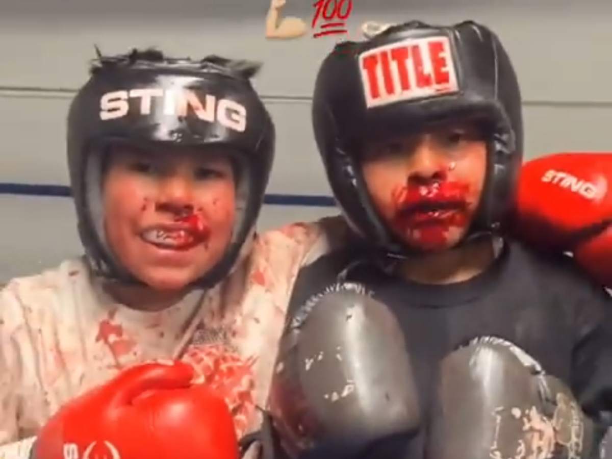 Kids bloodied up in sparring