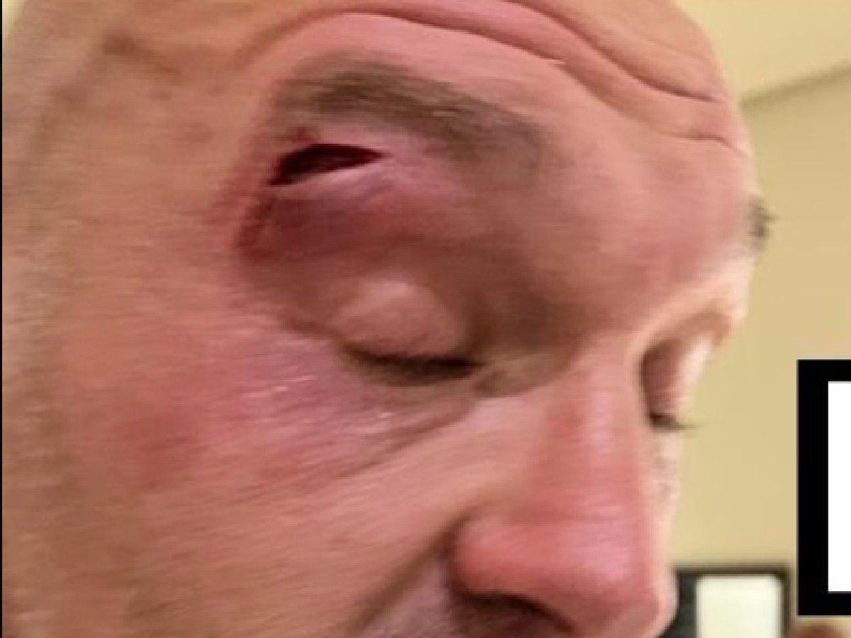 Footage of Tyson Fury being cut revealed