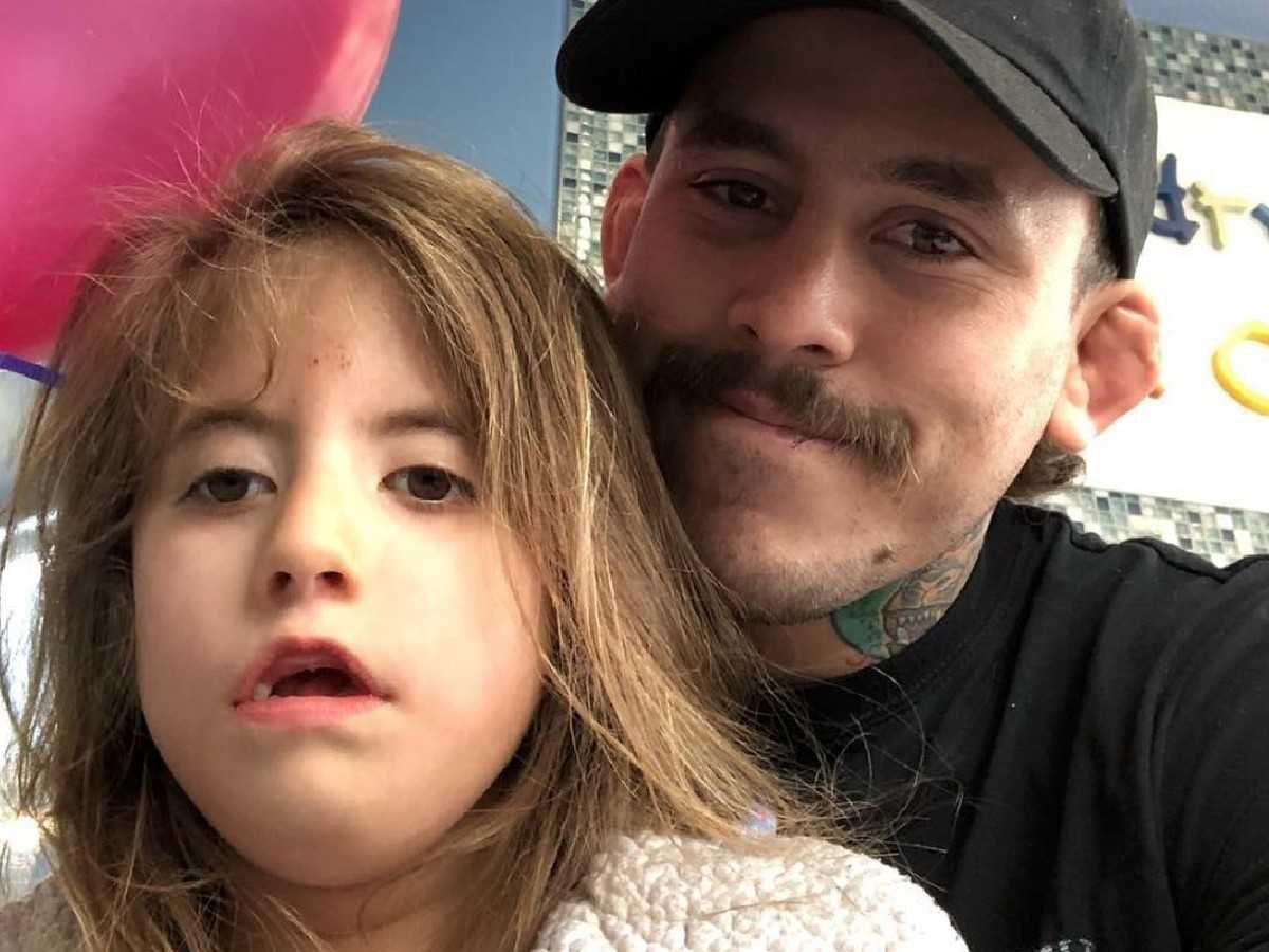 Chito Vera daughter: What is Moebius syndrome and how does it affect UFC star’s child?