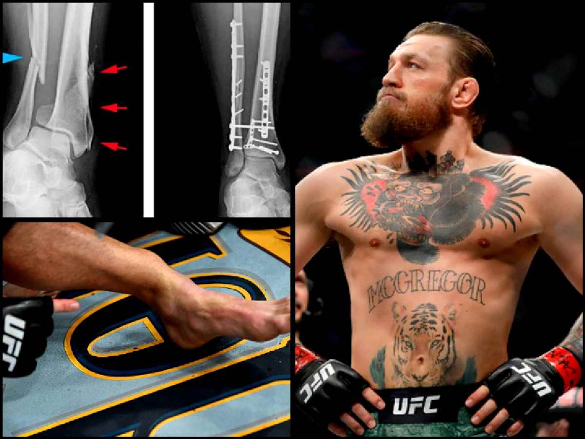 Conor McGregor is healed and ready to return