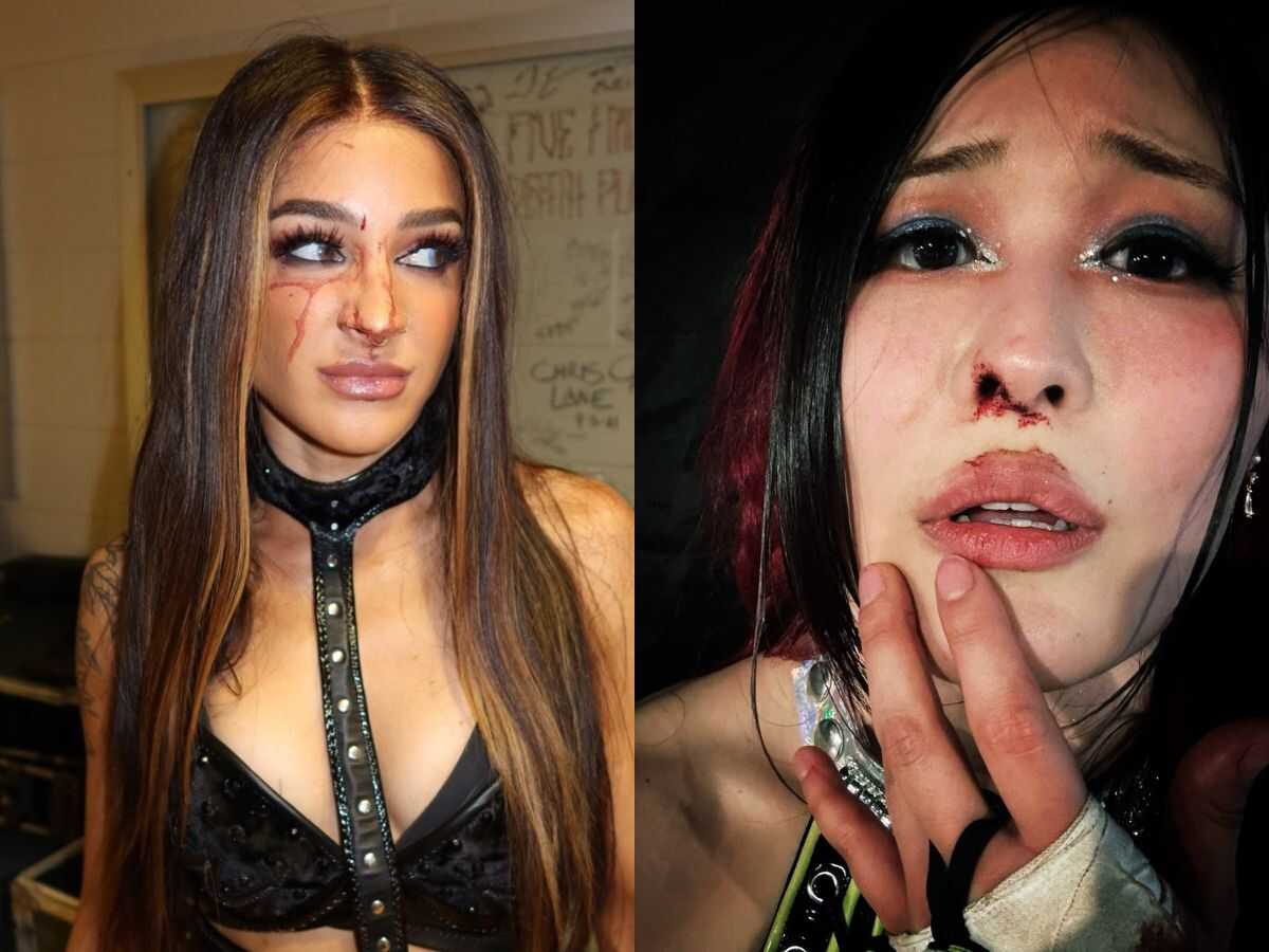 Iyo Sky and Dakota Kai shows BLOODY battle scars after WWE Raw