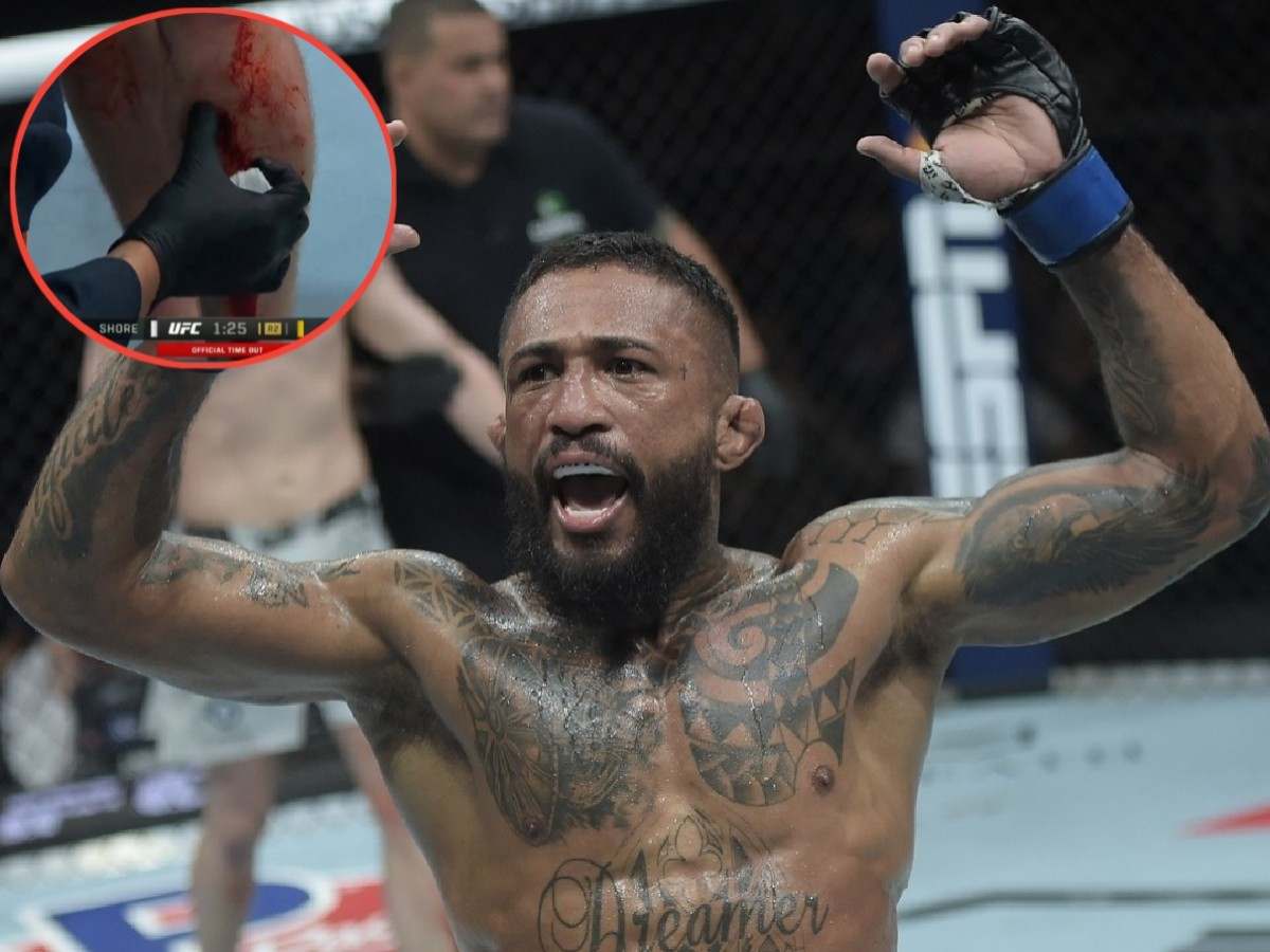 GRAPHIC WARNING! UFC 301’s brutal leg cut stops bout leaving fight fans in shock