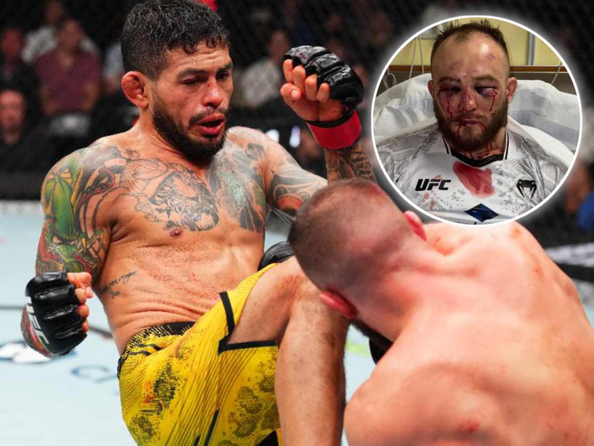 Graphic Warning! UFC St Louis fighter’s damaged eyes after war makes fans worry for health 