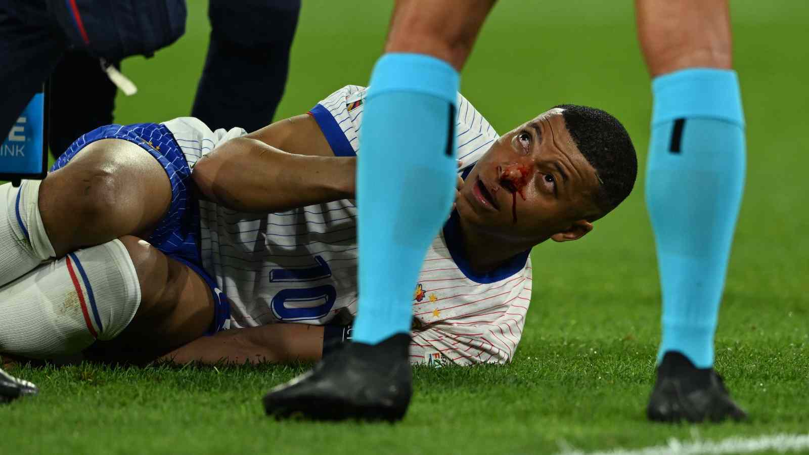 Kylian Mbappe has a subtle ‘4-word’ reaction to possibly wearing mask for rest of Euros after breaking his nose in France’s opener