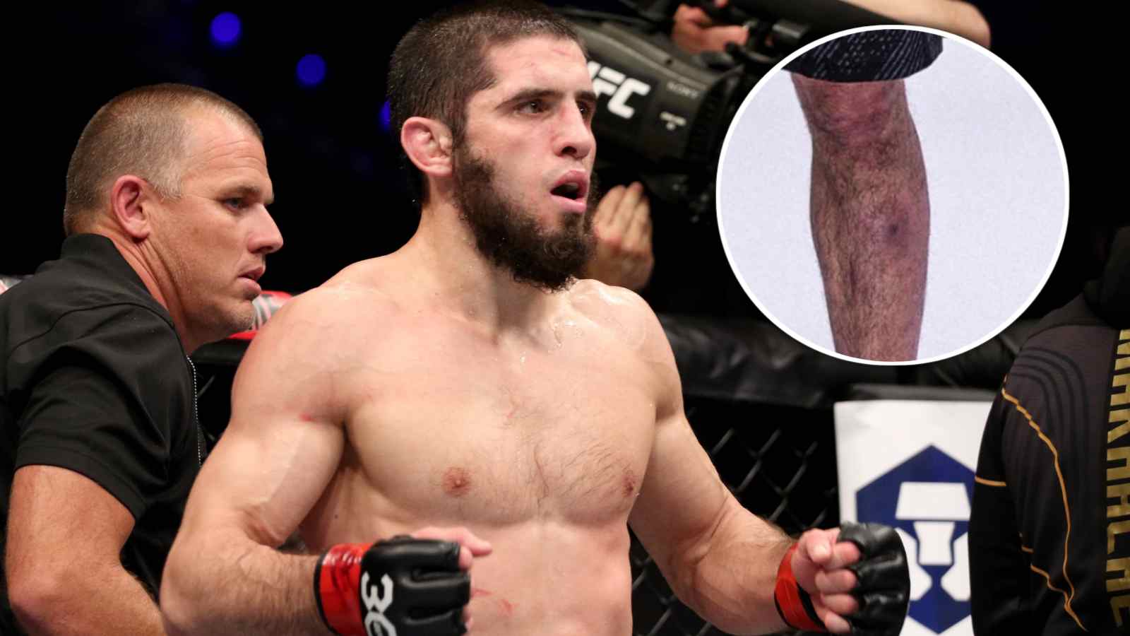 Islam Makhachev admits VIRAL images of staph infection were real heading into UFC 302