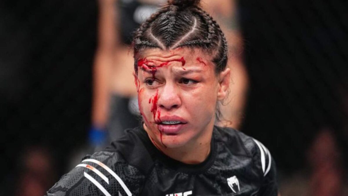 
Mayra Bueno Silva could not continue  fighting after a huge cut against Macy Chiasson UFC 303