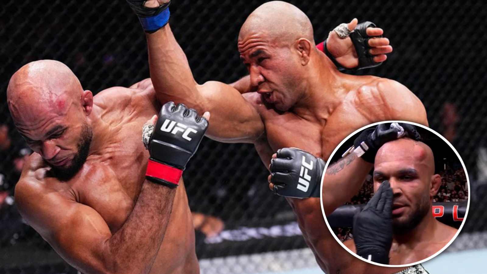 “That’s a golf ball” – UFC 304 star suffers crazy damage on head after war against ‘Robocop’; fans react