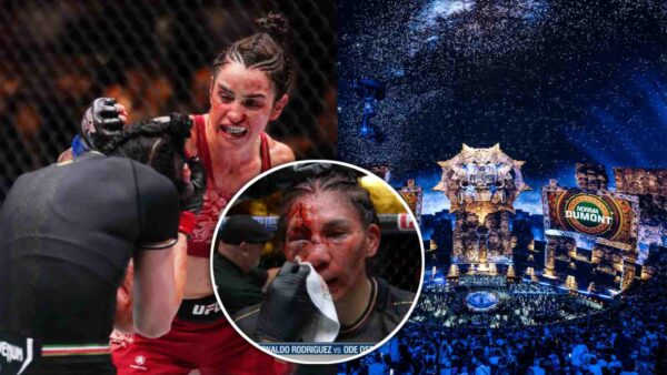 Irene Aldana suffers a nasty cut from Norma Dumont at UFC 306