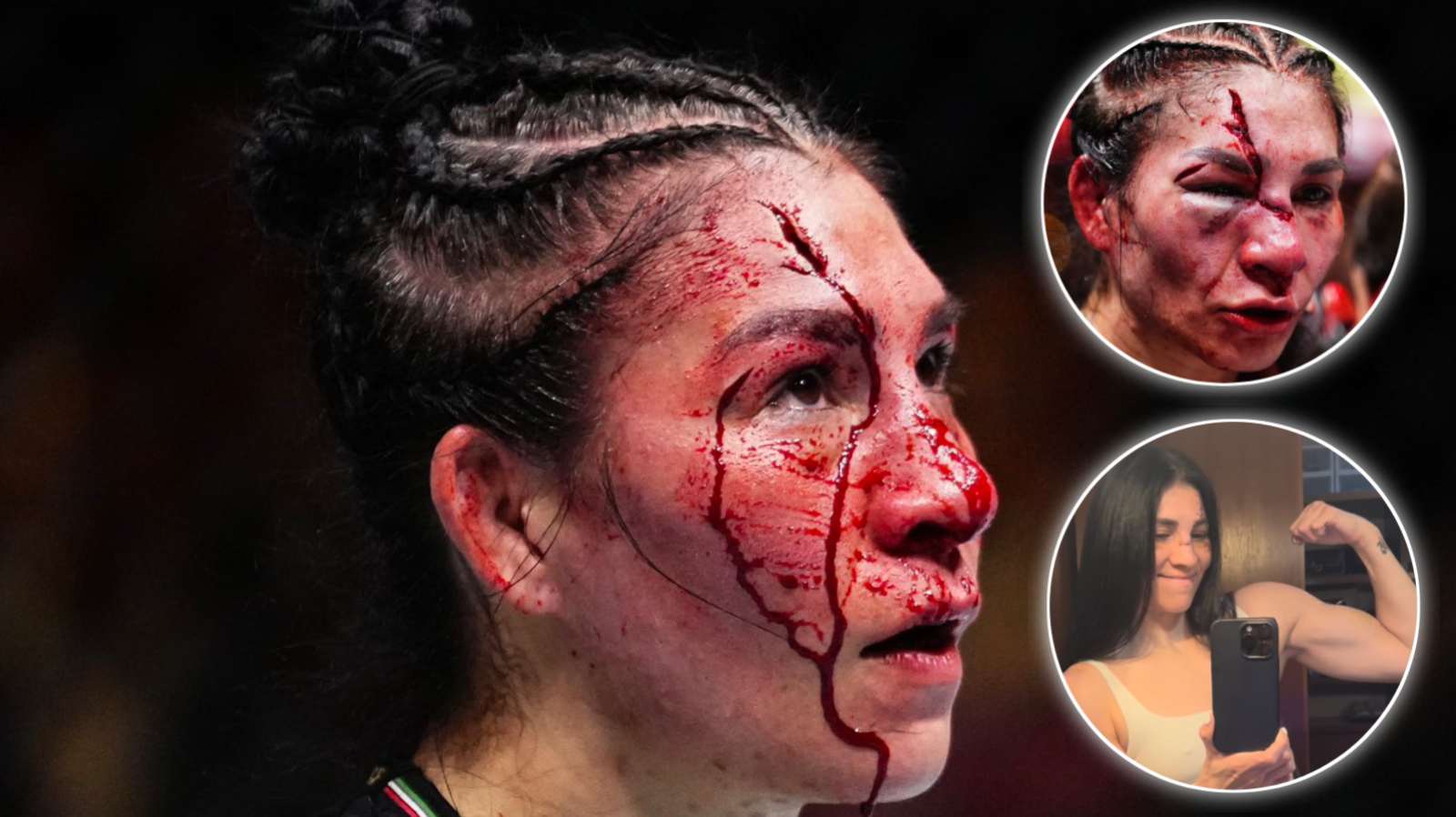 “She is the Wolverine” – Female fighter who got face disfigured at UFC 306 impresses fans with progress 