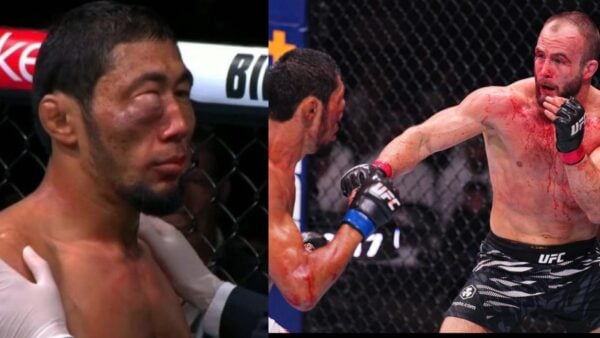 UFC 308 fighter injures his eye and loses the fight