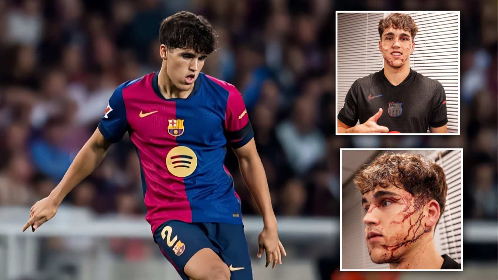 BRUTAL tackle on Pau Cubarsi leaves Barcelona star needing 10 STITCHES