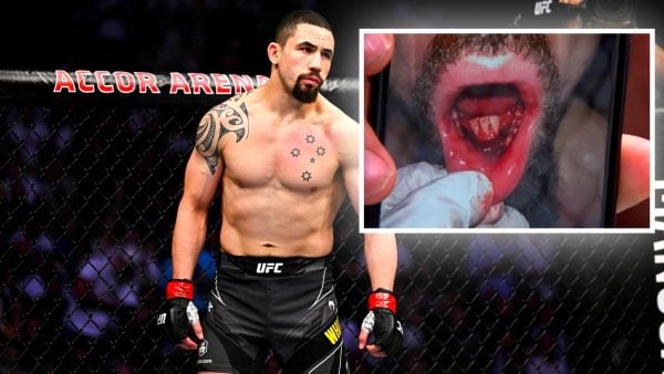 Doctors find ‘massive cyst’ during routine surgery on Robert Whittaker after UFC 308