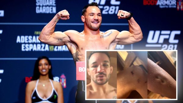 Michael Chandler shows off pitting swelling from UFC 309 rematch vs. Charles Oliveira