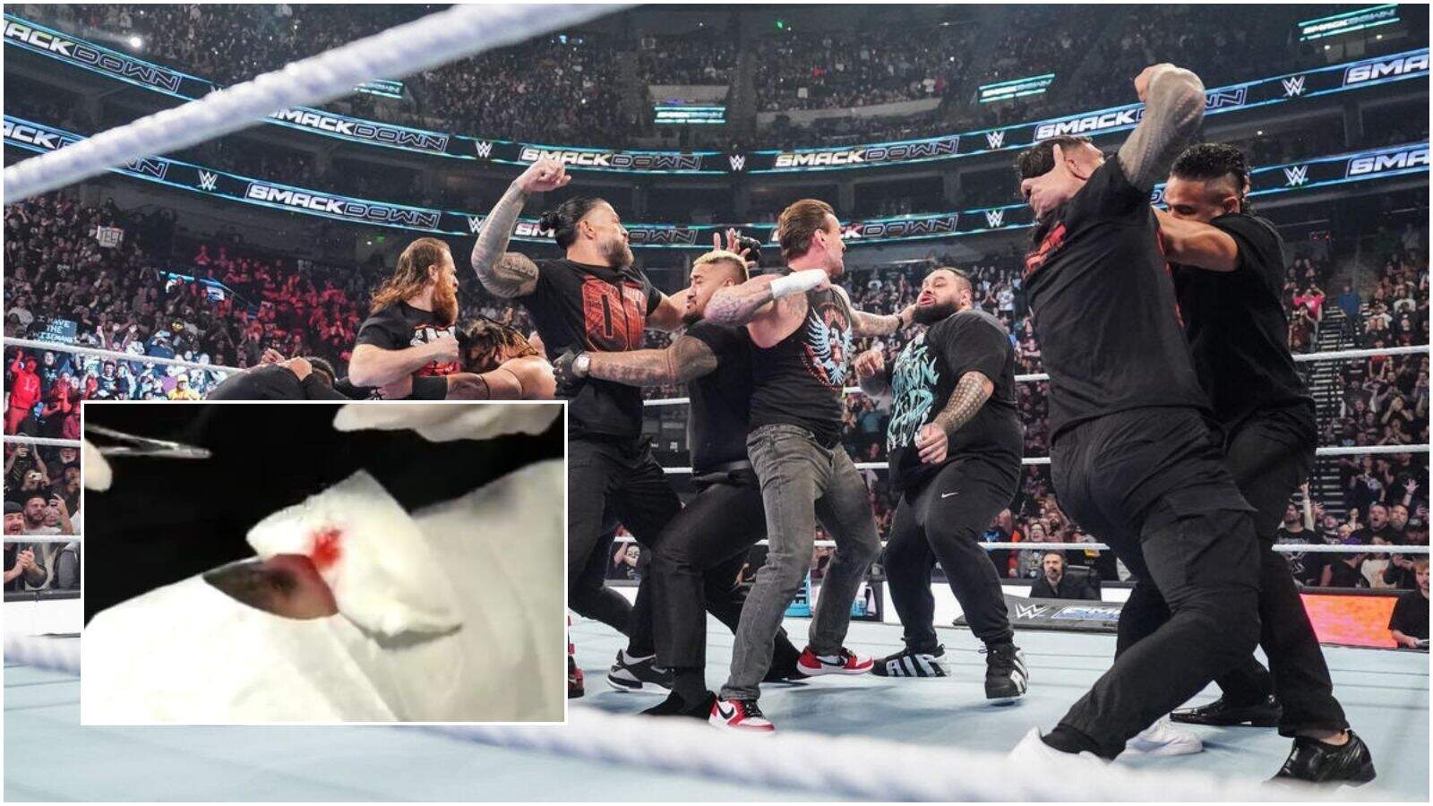 GRAPHIC WARNING! “My wife’s gonna love this,” New Bloodline member breaks silence on nasty battle scars after chaotic ending to SmackDown